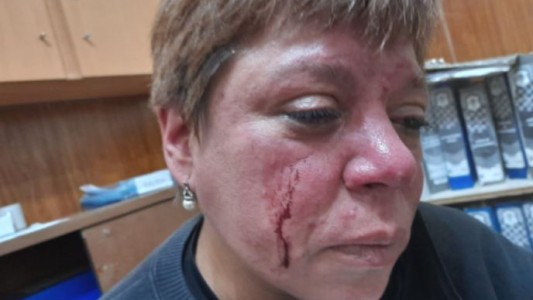 Una inspectora municipal fue agredida en La Plata por los dueños de una hamburguesería