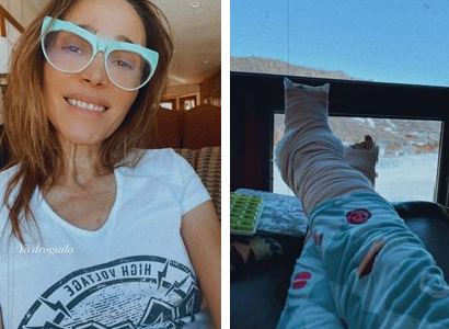 Las fotos de Vero Lozano luego de su accidente