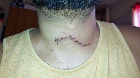 Carlos Paz: en intento de robo atacan con un cuchillo a taxista