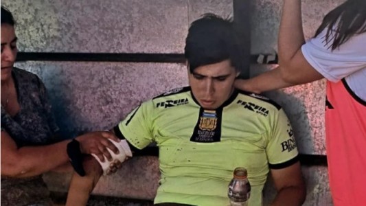 Lamentable: un árbitro asistente terminó en el hospital por la caída de una bengala en el fútbol femenino