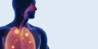 Fibrosis quística: Desarrollan medicamentos inhalables con antibióticos