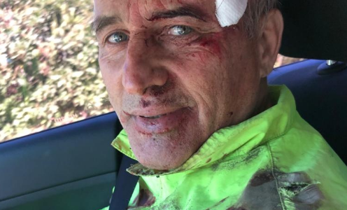 Se accidentó en bici el diputado nacional Baldassi