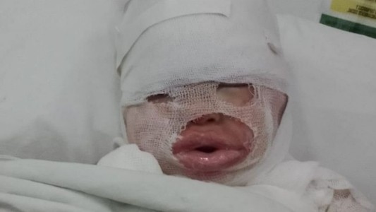 Habló la mamá de la nena de 3 años que sufrió quemaduras con aceite: "Quiero que la empleada dé la cara"