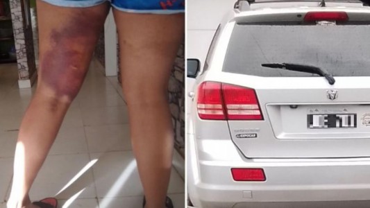Tras un choque, dos mujeres se tomaron de los pelos y una atropelló a la otra