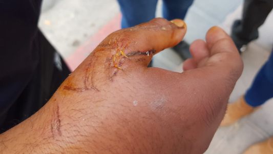 Temor por un pitbull suelto en barrio Ituzaingó