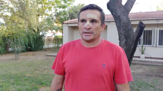 Le fracturaron el tabique al vicepresidente de Huracán