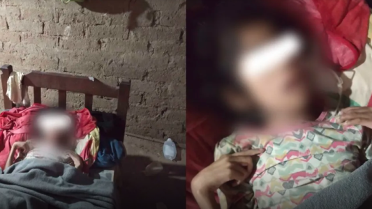 La nena de 12 años que quedó huérfana y vive en condiciones extremas: no come y los chanchos le comieron los dedos