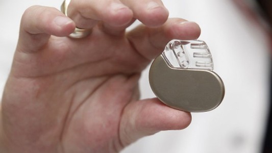 Procesaron a un médico por vender un marcapasos de PAMI a través de Mercado Libre