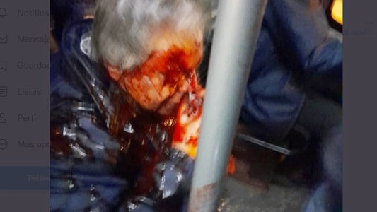 Detuvieron a un adolescente de 15 años acusado de atacar a un colectivero en Luján