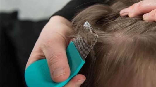 Una cordobesa se gana la vida sacando piojos: cobra $500 la sesión