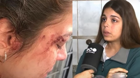 Cayeron los delincuentes que asaltaron y golpearon a una comerciante