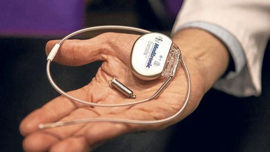 Por primera vez en Argentina, implantan marcapasos del tamaño de una píldora