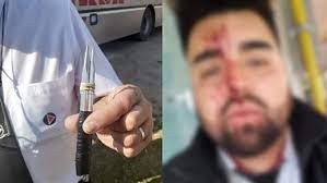 Un chofer defendió a una pasajera tras un robo y resultó herido