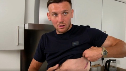 Futbolista mostró el desfibrilador que le implantaron debajo de su piel