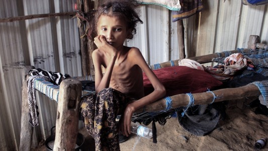 Cada cuatro segundos muerte una persona de hambre en el mundo