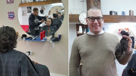 Médico donó su pelo para pelucas de pacientes con cáncer