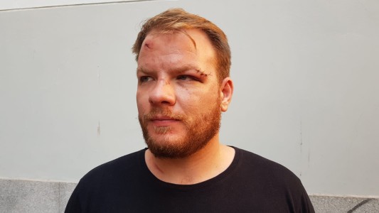 Atacaron, golpearon y le robaron a un periodista en Carlos Paz