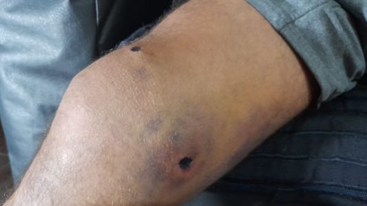 Le quisieron robar la moto y le dispararon en la pierna