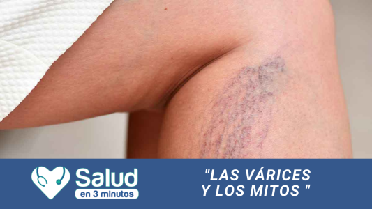 Las Várices: ¿por qué se manifiestan? ¿cuáles son las principales causas?