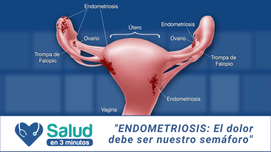 ¿Cómo podemos detectar la endometriosis?