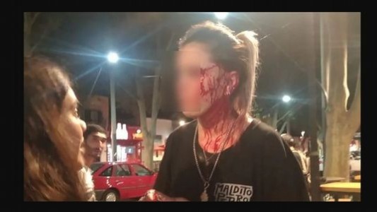 Brutal agresión a una moza con un vaso en un bar de Mendoza: "Me arruinaron"