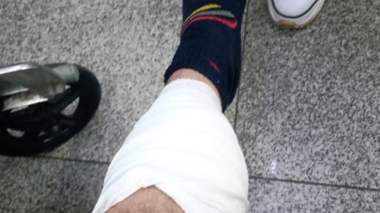 Inseguridad sin fin: balearon a un delivery para robarle