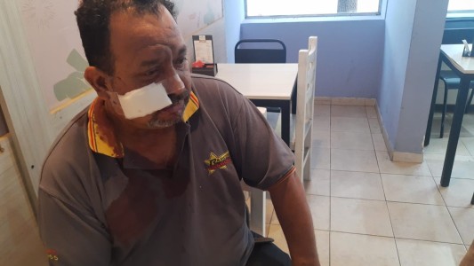 Taxista fue desfigurado en la cara con una botella rota para robarle