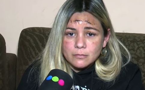 Gisel, la mujer baleada en la cabeza en un asalto, se fue de Córdoba