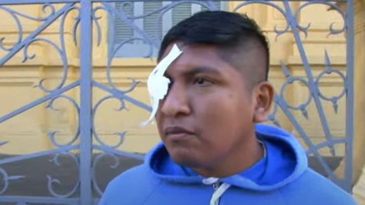 Lo golpearon en el ojo para robarle y ahora puede perderlo