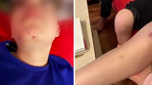 Nene de 10 años entró por error en la cancha de golf de un country y una pareja lo atacó a pelotazos