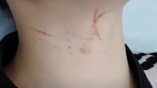 Denuncian bullying contra un niño de 11 años que terminó hospitalizado