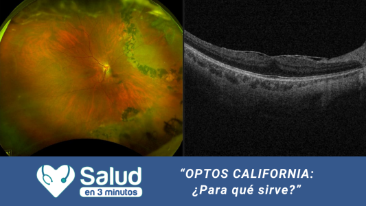 “OPTOS CALIFORNIA”: Una herramienta vital para conocer enfermedades de la retina