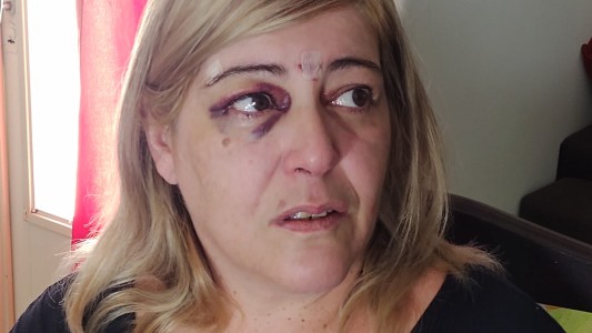 El dramático testimonio de una madre y su hija tras ser violentamente asaltadas