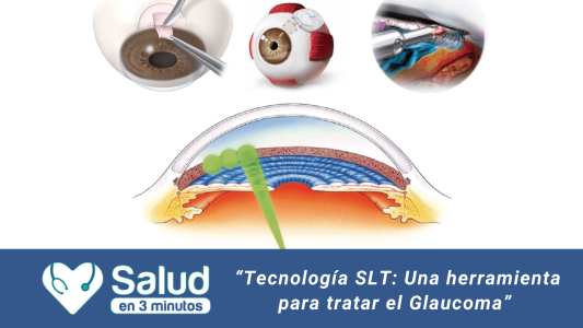 GLAUCOMA: la silenciosa enfermedad ocular que deteriora la visión para siempre