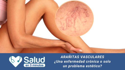 Arañitas vasculares: ¿Por qué no son un problema estético?