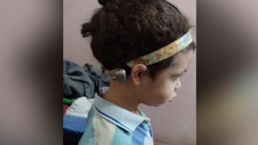 Le robaron a Uriel un audífono que cuesta $10 millones