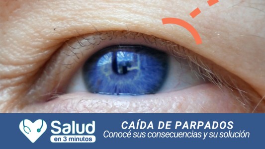 Blefaroplastia: “La solución para poder recuperar la apertura de los ojos”