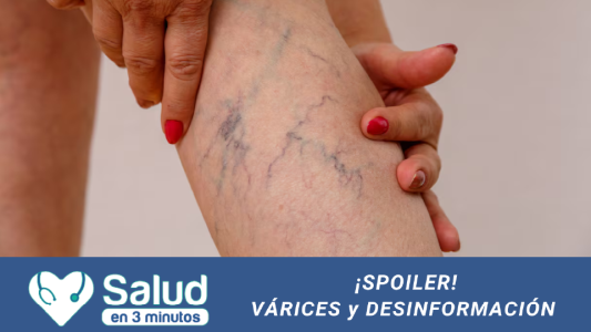 Insuficinecia venosa y desinformación