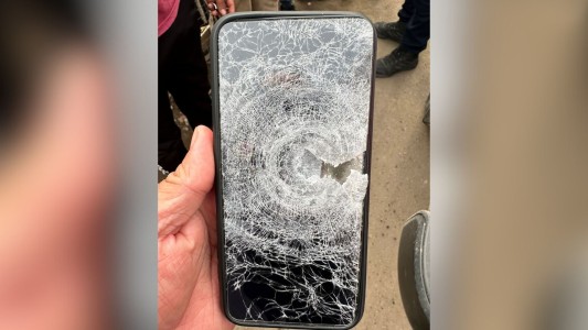 Le dispararon a un joven de 25 años en la pierna y se salvó gracias al celular