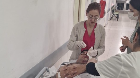 Un policía perdió un ojo cuando lo apedrearon para recuperar un auto robado