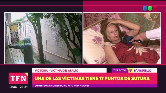 Un ladrón golpeó violentamente a un jubilado durante un asalto en barrio Argüello: la víctima terminó con 17 puntos