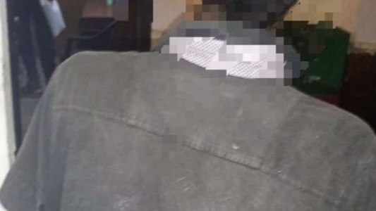 Mordió a un policía cuando intentaba huir tras cometer un robo