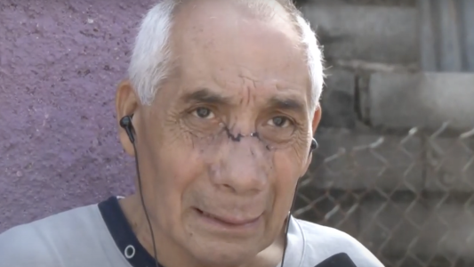 Omar quiso salvar a un vecino de un asalto, lo atacaron y estuvo al borde de la muerte