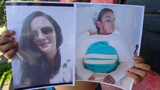 Realizarán una marcha por la mujer quemada con ácido: familiares exigen que atrapen al agresor