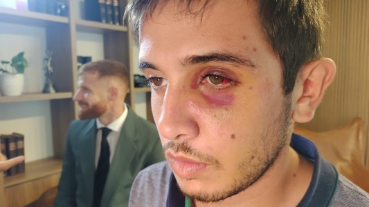 Una patota emboscó y golpeó a un joven en un boliche y una chica le salvó la vida con RCP