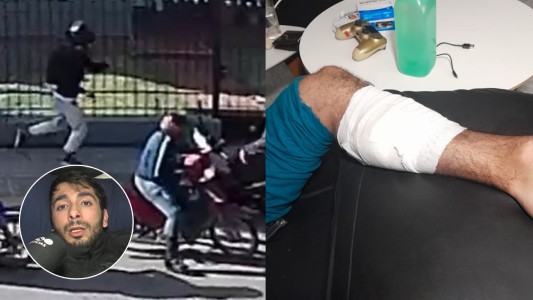 Habló Ernesto, el joven que balearon para robarle la moto en Córdoba