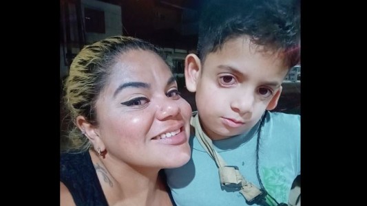 El caso del niño Milo Lockett con anomalías faciales: necesita una casa sin humedad para vivir sin ahogarse