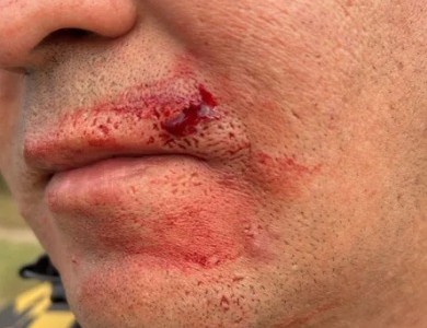 Video: agredió a un policía durante un control y fue detenido