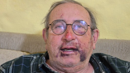 Violento episodio: asfixiaron y golpearon a un jubilado para robarle en su casa