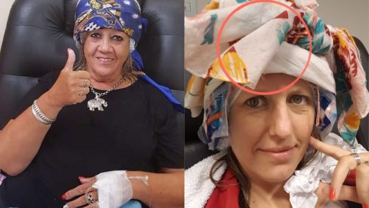 “Quimio con Pelo Córdoba”: una red que ayuda a preservar la identidad durante el tratamiento oncológico